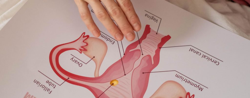 Cáncer Cervico Uterino