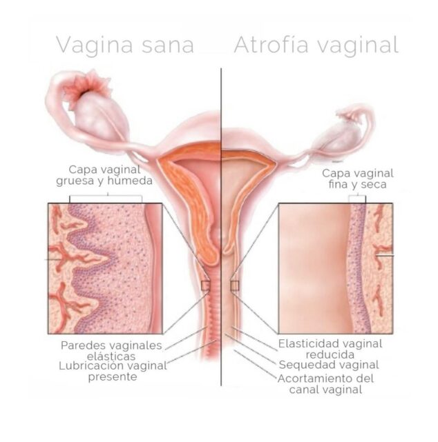 salud-genital-en-clinica-doctora-flores-de-apodaca-634x641